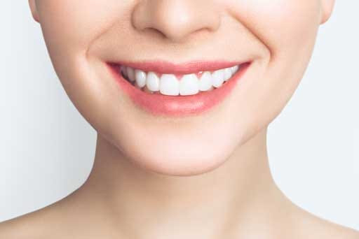 teeth whitening surrey