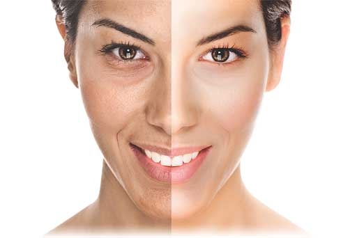 oxygeneo facial surrey