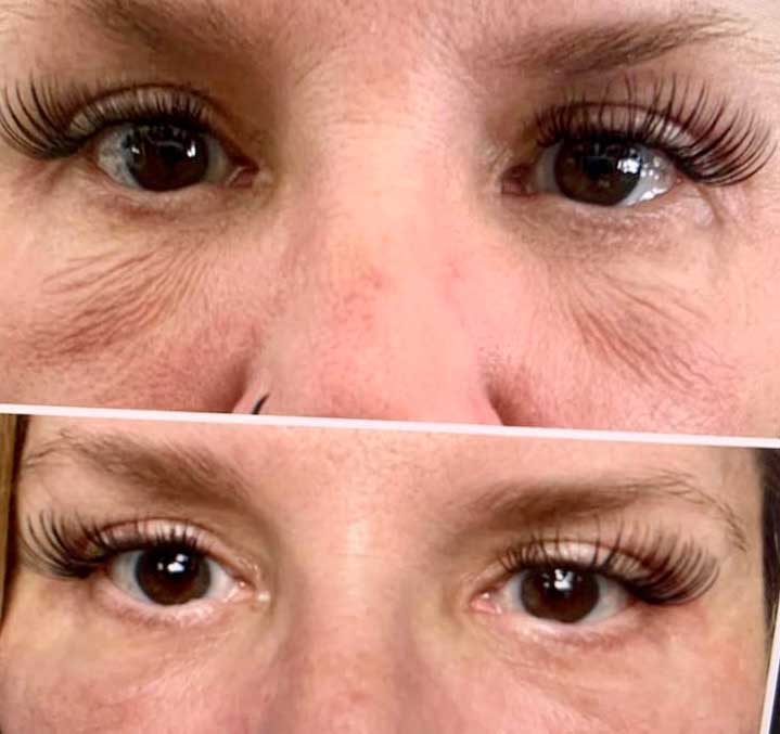 Eye Peel Before After